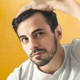 Products for Hair Loss 