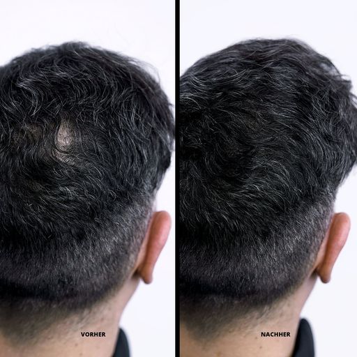Super Million Hair Haarfasern Light-Gray (13)